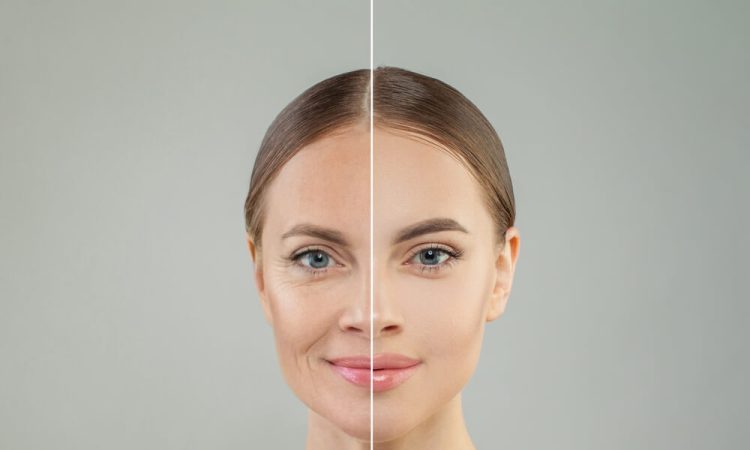 What Is Ozempic Face And How Does It Impact Your Appearance